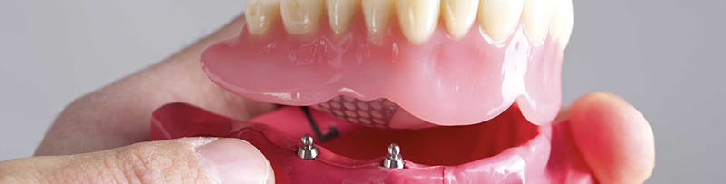 Restorative Dentistry Flat Rock MI